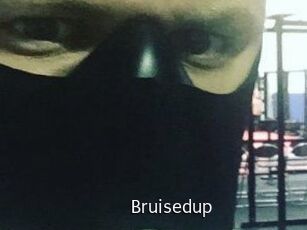Bruisedup