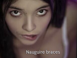 Nauguire_braces