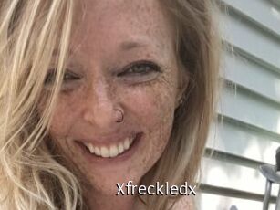 Xfreckledx